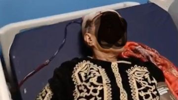 ضربها بالفأس في رأسها.. سوهاج الجامعي ينقذ حياة مسنة مصابة بكسور في الجمجمة