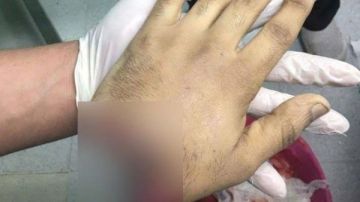 ضحية البلطجة في الهرم : ضربوني وسرقوا التليفون تفاصيل مأساوية