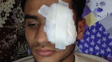 رفض الاعتد.اء على السيدات.. ضبط الكوارشي المتهم بفـ.قع عين شاب