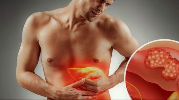 يسبب التليف.. أعراض الكبد الدهني وأهم أسبابه