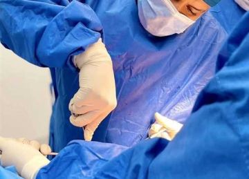 فريق طبي بجامعة أسيوط ينجح في استئصال ورم خبيث بالمريء لمريض من غزة