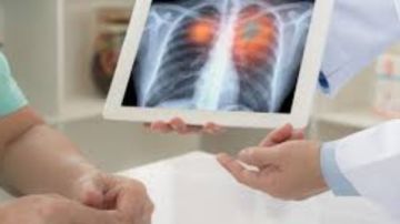 الصحة تنظم دورات تدريبية لرفع كفاءة الأطقم الطبية بالمستشفيات الصدرية الصحة تنظم دورات تدريبية لرفع كفاءة الأطقم الطبية بالمستشفيات الصدرية