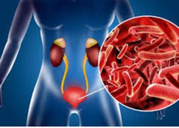 سبب رئيسي في أمراض الكلى.. 9 علامات شائعة لـ التهاب المسالك البولية