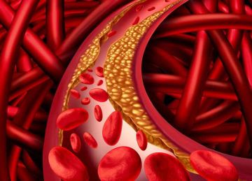 هالات بيضاء حول العين.. علامات القاتل الصامت وارتفاع الكوليسترول بالدم