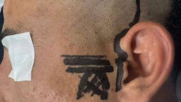 إجراء جراحة دقيقة وغير مسبوقة بمستشفى العامرية بالإسكندرية.. صور إجراء جراحة دقيقة وغير مسبوقة بمستشفى العامرية بالإسكندرية.. صور