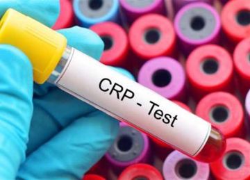 إرهاق مزمن وجوع مستمر.. علامات مقاومة الأنسولين عند النساء