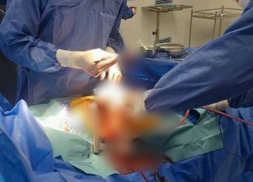 مطعون بالصدر .. إنقاذ حياة مصاب بـ تهتك رئة وقطع بالحجاب الحاجز في الإسكندرية  مطعون بالصدر .. إنقاذ حياة مصاب بـ تهتك رئة وقطع بالحجاب الحاجز في الإسكندرية