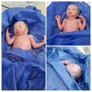 صحة المنيا: ولادة نادرة لثلاثة توائم بمستشفى العدوة المركزى صحة المنيا: ولادة نادرة لثلاثة توائم بمستشفى العدوة المركزى