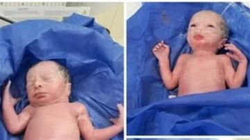 صحة المنيا: ولادة ثلاثة توائم ويتمتعون بصحة جيدة بمستشفى العدوة المركزى