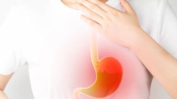 مش هتتوقعها .. وصفات طبيعية لعلاج الحموضة أغربها عصير البطيخ