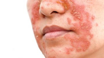 مخاطر أدوات التجميل في العيد.. لا تضعي بشرتك على المحك