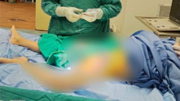 مصاب بالإيدز .. الأطباء تكشف عن معجزة لإنقاذ طفل في مستشفى العامرية