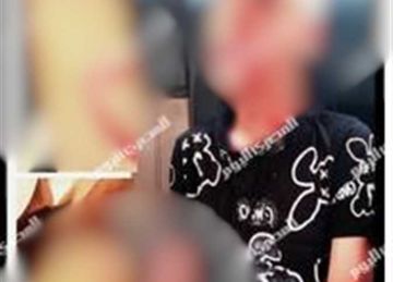  كان نفسه يطلع دكتور .. صغير أرض اللواء يفقد عينه اليسرى بسبب علبتي عصير (فيديو)