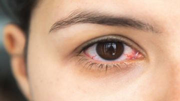 6 علامات خطيرة في العين قد تكشف عن نوبة قلبية وشيكة تفاصيل