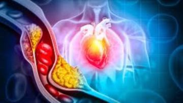 غير المسبك.. أكلات غير متوقعة ترفع الكوليسترول