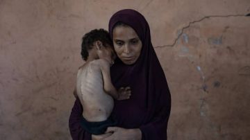 كندا تدين استهداف موظفي الأمم المتحدة وتدعو لمحاربة الجوع في غزة