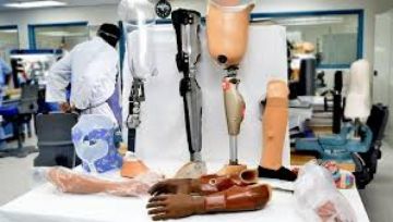 تجهيز مراكز التجميع ضمن مشروع توطين صناعة الأطراف الصناعية بـ6 محافظات