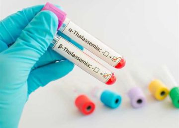 ما هو مرض الثلاسيميا؟.. تعرف على أعراضه وطرق علاجه