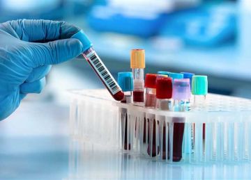 رغم شعورك بتحسن.. 5 تحاليل دم يجب على كل شخص بالغ إجراؤها