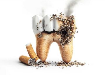 3 طرق فعالة لإزالة بقع التدخين من الأسنان 3 طرق فعالة لإزالة بقع التدخين من الأسنان