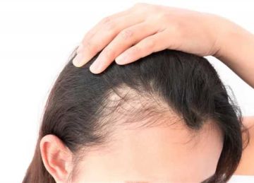 الزيوت الطبيعية وتجنب مجفف الشعر.. طرق فعالة في علاج تساقط الشعر