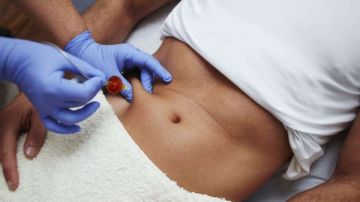 العلاج الطبيعي تحذر أعضاءها من استخدام حقن الميزوثيرابي