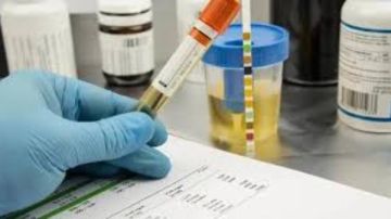 هل تظهر السيجارة في تحليل المخدرات؟.. طبيبة توضح الحقيقة كاملة