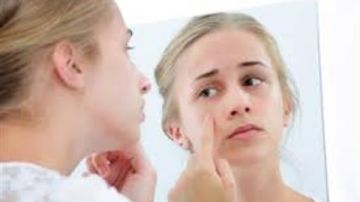 تظهر على الوجه.. 5 علامات تحذيرية لارتفاع الكوليسترول