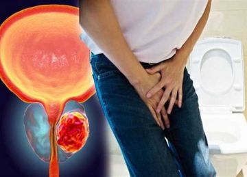 منها الذهاب بكثرة إلى الحمام .. 6 علامات مبكرة تدل على سرطان البروستاتا يتم تجاهلها