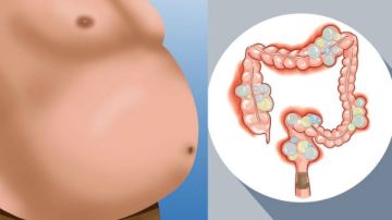 حل سريع في البيت.. علاج غازات البطن وتنظيف القولون حل سريع في البيت.. علاج غازات البطن وتنظيف القولون