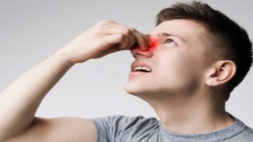 10 خطوات لإيقاف نزيف الأنف في الصيف