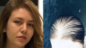 إصابة جديدة تتعرض لها رحمة حسن بعد الصلع إصابة جديدة تتعرض لها رحمة حسن بعد الصلع