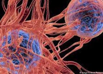  الموز الأخضر والعدس .. أطعمة تقلل خطر هذا النوع من السرطان بنسبة 60 