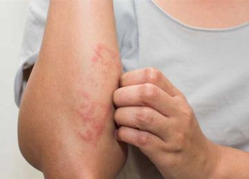 تصيب 25٪ من صغار السن.. طبيب يكشف حالة طبية تسبب التنمر في المدارس تصيب 25٪ من صغار السن.. طبيب يكشف حالة طبية تسبب التنمر في المدارس