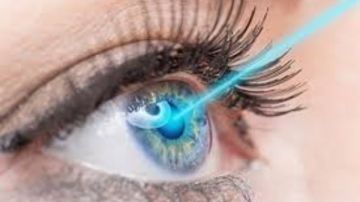 تقنية جديدة لتصحيح مشاكل الرؤية.. بديلة لجراحات الليزك