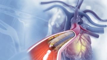 تنظف الشرايين والقلب .. أطعمة خارقة عليك تناولها يوميا