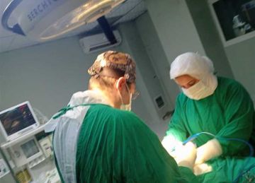 زراعة رئة خنزير في جسد إنسان.. الصين تكشف عن أول تجربة ناجحة عالميا (التفاصيل)