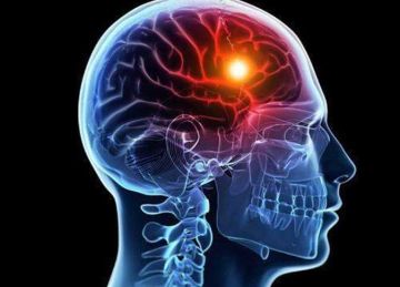 هل رفة العين مجرد عرض بسيط أم ناقوس خطر لسكتة دماغية؟ (تفاصيل)