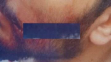 شهود عيان.. تفاصيل مرعبة بحادث شق وش طبيب امتياز بمستشفى سيد جلال شهود عيان.. تفاصيل مرعبة بحادث شق وش طبيب امتياز بمستشفى سيد جلال