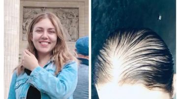 مش هسكت عن حقي.. رحمة حسن تهدد بالشكوى بعد إصابتها بالصلع مش هسكت عن حقي.. رحمة حسن تهدد بالشكوى بعد إصابتها بالصلع