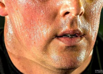 لو بتعرق كتير.. 5 علامات تشير إلى نقص فيتامين د على الجلد والساقين