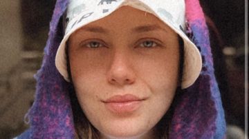 رحمة حسن: شعري بيقع من سنتين وقلبي مكسور