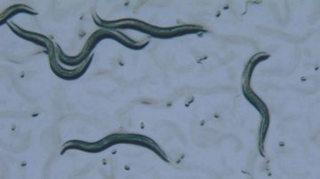 تدمر الدماغ ديدان تتسلل للمخ وتسبب أمراض خطيرة.. موجودة في 6 أكلات