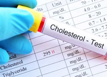 الكوليسترول الصامت عند النساء.. كيف تعرفين أنك معرضة للخطر؟ الكوليسترول الصامت عند النساء.. كيف تعرفين أنك معرضة للخطر؟