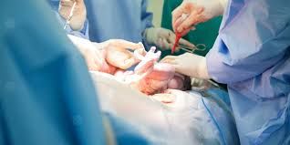 صحة النواب: حل أزمة الولادة القيصرية يبدأ بدعم الطبيعية بمستشفيات الحكومة صحة النواب: حل أزمة الولادة القيصرية يبدأ بدعم الطبيعية بمستشفيات الحكومة