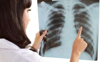 نشرة المرأة والمنوعات جميلة عزيز توثق معركتها مع السرطان.. لا تتجاهل هذه العلامات قد تكون جلطة في الرئة نشرة المرأة والمنوعات جميلة عزيز توثق معركتها مع السرطان.. لا تتجاهل هذه العلامات قد تكون جلطة في الرئة