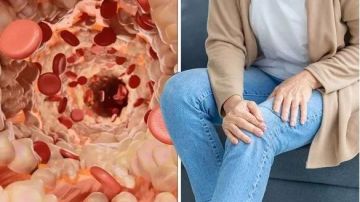 بالساق والقدمين .. 5 علامات غير عادية تشير إلى ارتفاع مستويات الكوليسترول الضار في الدم