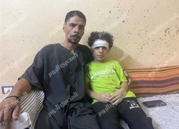 100 غرزة على وجه صغير المرج .. ووالدته تموت بحسرتها بعد ساعات من الاعتداء (قصة كاملة)