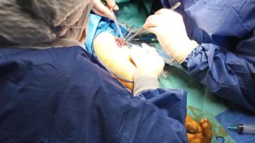 إجراء جراحة عاجلة لإنقاذ ذراع مريض من البتر بمستشفى أبوكبير