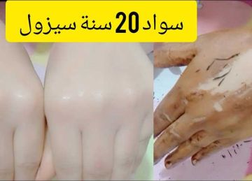  هتقضي على سواد السنين .. خلطات تفتيح للبشرة طبيعية بالكركم والبرتقال